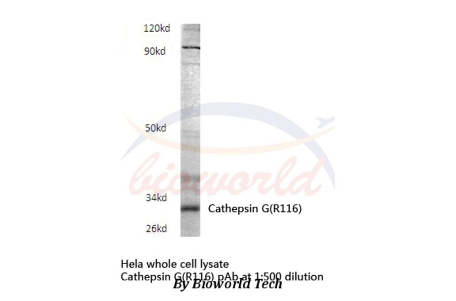 Anti-Cathepsin G (R116) Antibody from Bioworld Technology (BS3458) - Antibodies.com
