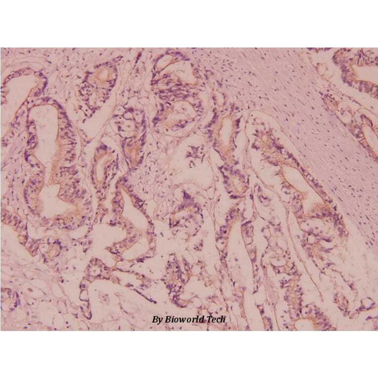 Anti-Nephrin (H892) Antibody from Bioworld Technology (BS3462) - Antibodies.com