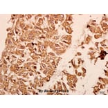 Anti-Neuropilin-1 (D525) Antibody from Bioworld Technology (BS3465) - Antibodies.com