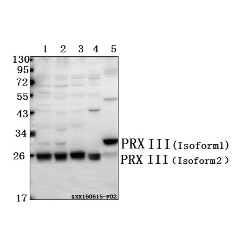Anti-PRX III (K93) Antibody from Bioworld Technology (BS3468) - Antibodies.com