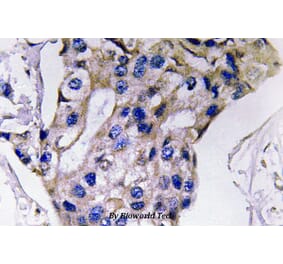 Anti-IL-5 (S92) Antibody from Bioworld Technology (BS3471) - Antibodies.com