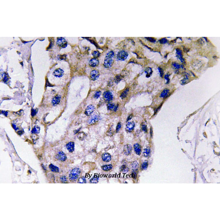 Anti-IL-5 (S92) Antibody from Bioworld Technology (BS3471) - Antibodies.com