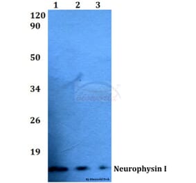 Anti-Neurophysin I (K40) Antibody from Bioworld Technology (BS3475) - Antibodies.com