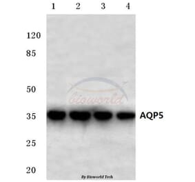 Anti-AQP5 (Y243) Antibody from Bioworld Technology (BS3477) - Antibodies.com