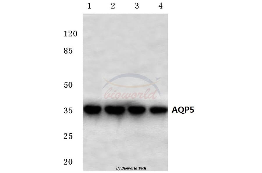 Anti-AQP5 (Y243) Antibody from Bioworld Technology (BS3477) - Antibodies.com