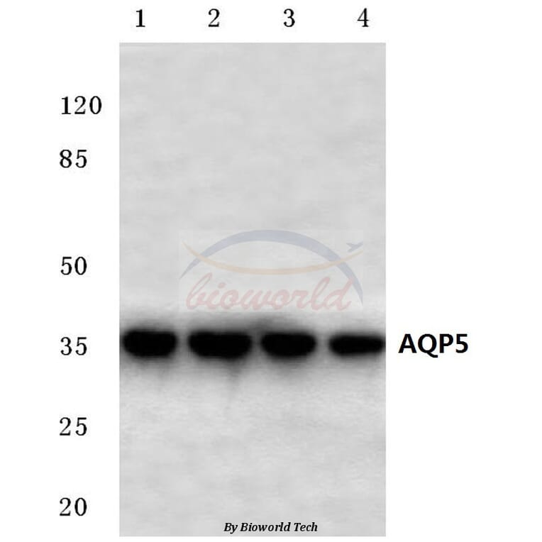 Anti-AQP5 (Y243) Antibody from Bioworld Technology (BS3477) - Antibodies.com