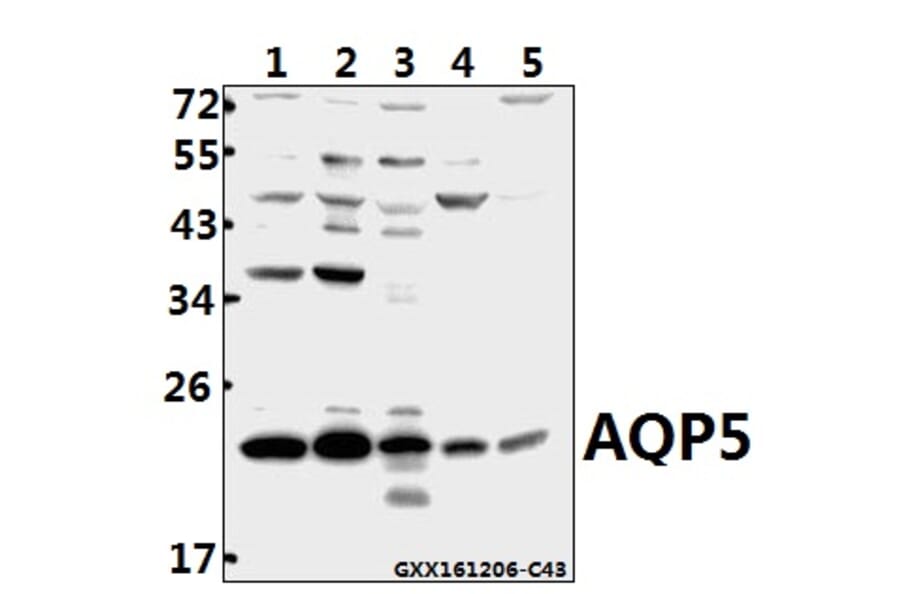 Anti-AQP5 (Y243) Antibody from Bioworld Technology (BS3477) - Antibodies.com