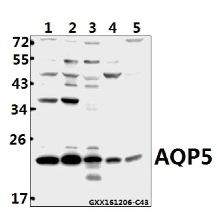 Anti-AQP5 (Y243) Antibody from Bioworld Technology (BS3477) - Antibodies.com