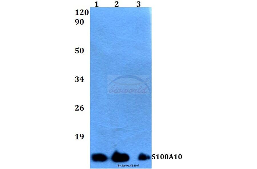Anti-S100A10 (V52) Antibody from Bioworld Technology (BS3478) - Antibodies.com