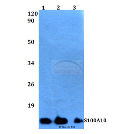 Anti-S100A10 (V52) Antibody from Bioworld Technology (BS3478) - Antibodies.com