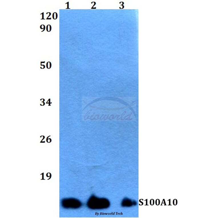 Anti-S100A10 (V52) Antibody from Bioworld Technology (BS3478) - Antibodies.com