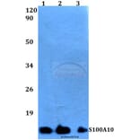 Anti-S100A10 (V52) Antibody from Bioworld Technology (BS3478) - Antibodies.com