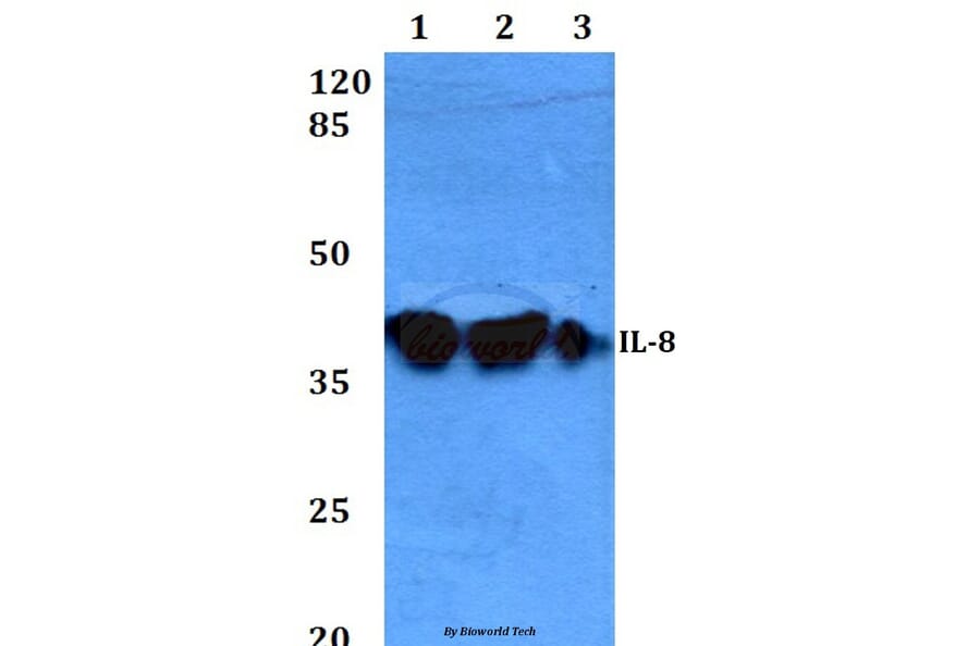 Anti-IL-8 (V68) Antibody from Bioworld Technology (BS3479) - Antibodies.com