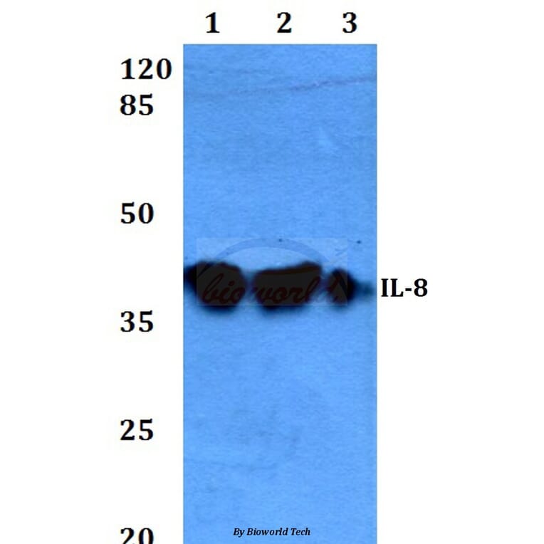 Anti-IL-8 (V68) Antibody from Bioworld Technology (BS3479) - Antibodies.com