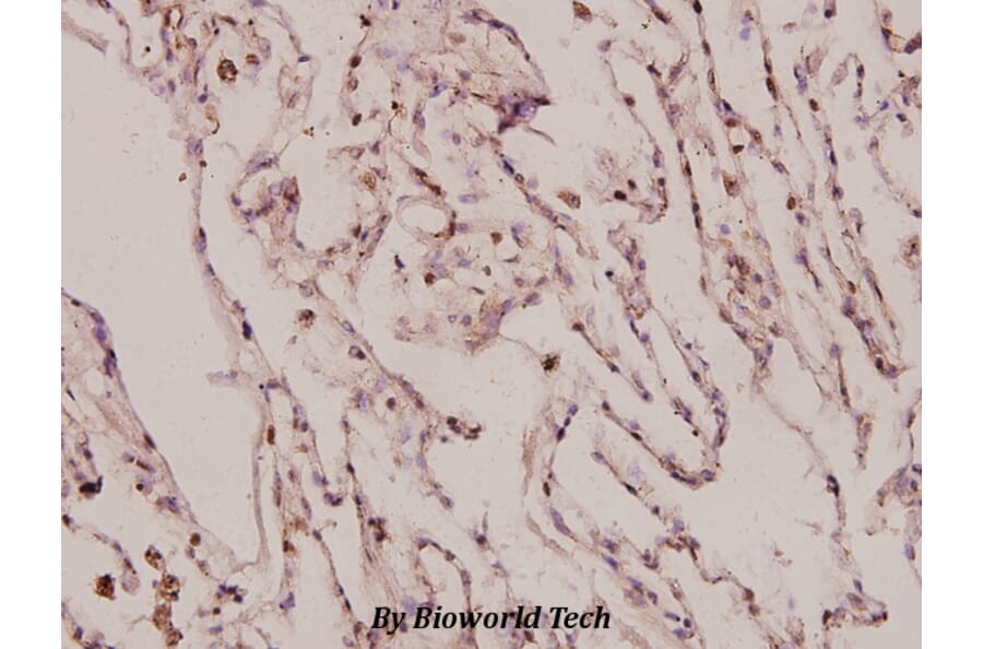 Anti-IL-8 (V68) Antibody from Bioworld Technology (BS3479) - Antibodies.com