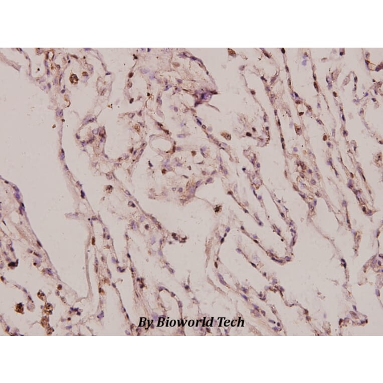 Anti-IL-8 (V68) Antibody from Bioworld Technology (BS3479) - Antibodies.com