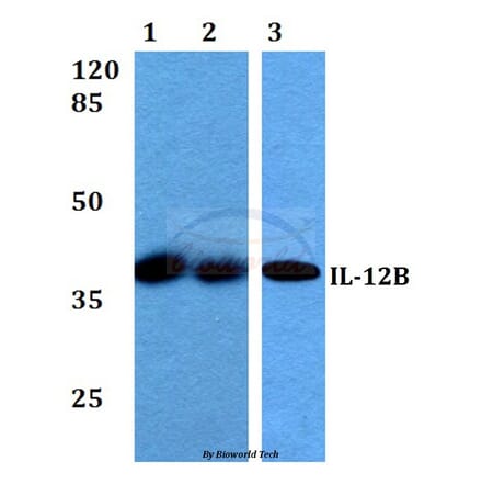 Anti-IL-12B (V277) Antibody from Bioworld Technology (BS3480) - Antibodies.com
