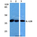 Anti-IL-12B (V277) Antibody from Bioworld Technology (BS3480) - Antibodies.com