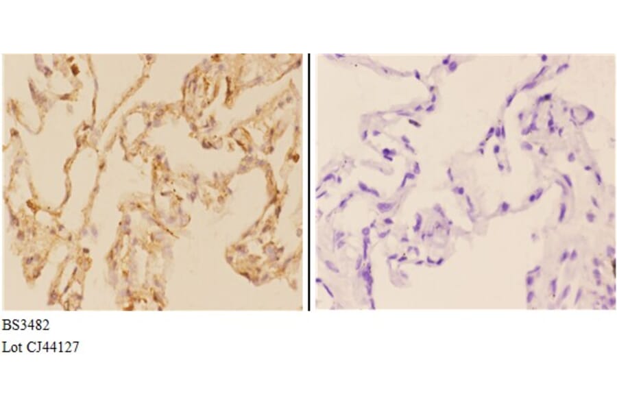 Anti-ABCG2 (N338) Antibody from Bioworld Technology (BS3482) - Antibodies.com