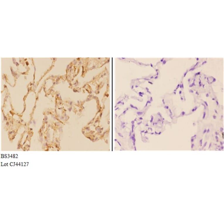 Anti-ABCG2 (N338) Antibody from Bioworld Technology (BS3482) - Antibodies.com