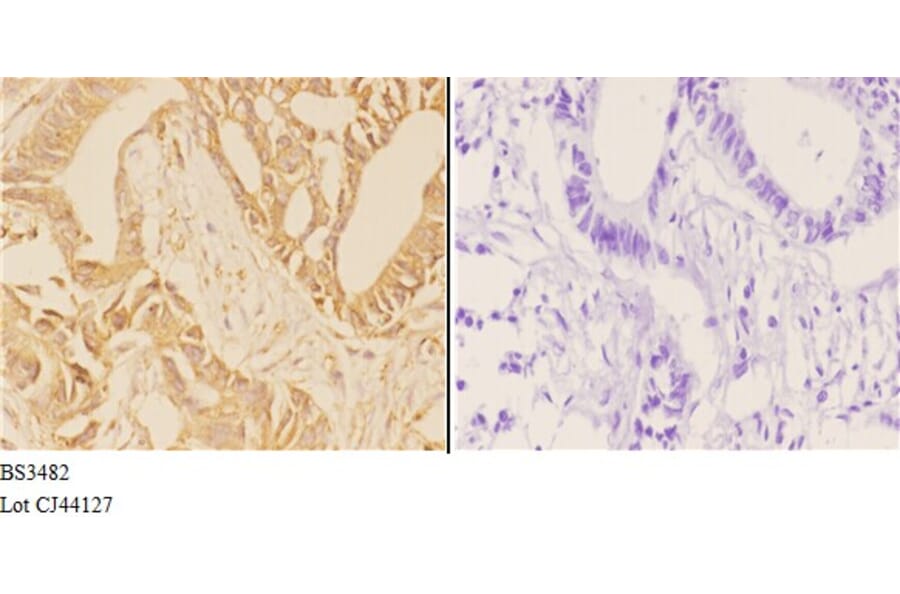Anti-ABCG2 (N338) Antibody from Bioworld Technology (BS3482) - Antibodies.com