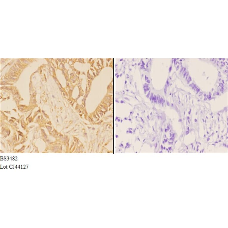 Anti-ABCG2 (N338) Antibody from Bioworld Technology (BS3482) - Antibodies.com