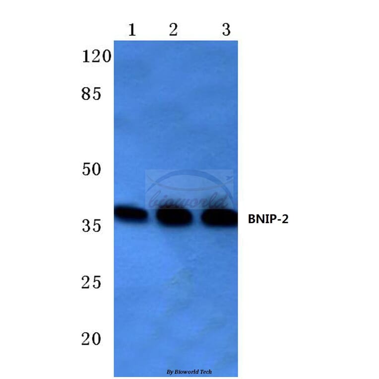 Anti-BNIP-2 (E122) Antibody from Bioworld Technology (BS3484) - Antibodies.com