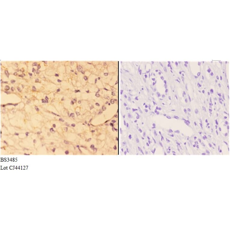 Anti-ACE (F940) Antibody from Bioworld Technology (BS3485) - Antibodies.com