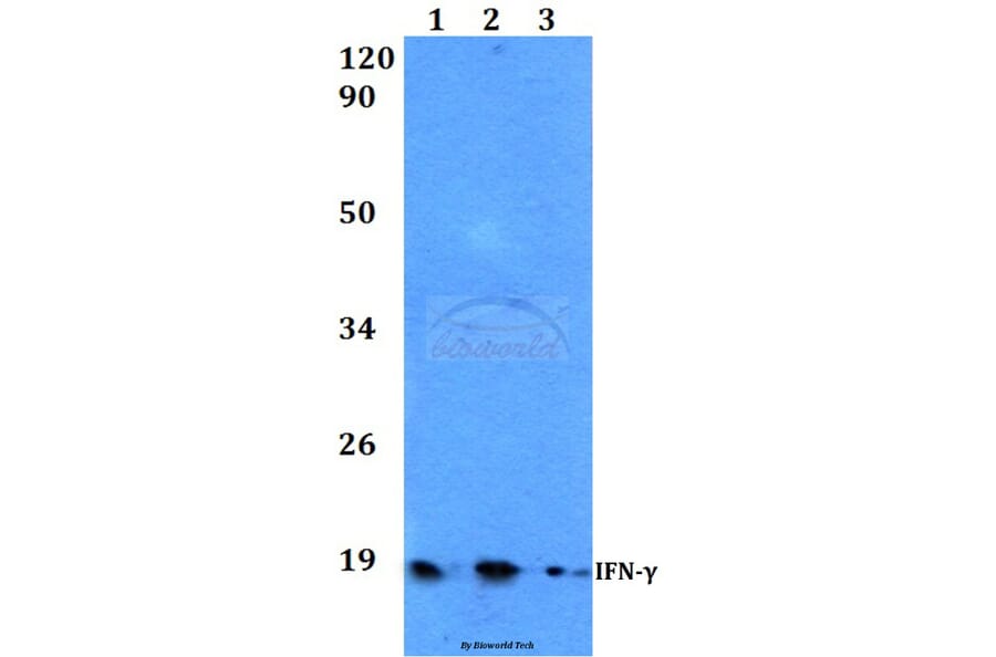 Anti-IFN-γ (Q69) Antibody from Bioworld Technology (BS3486) - Antibodies.com