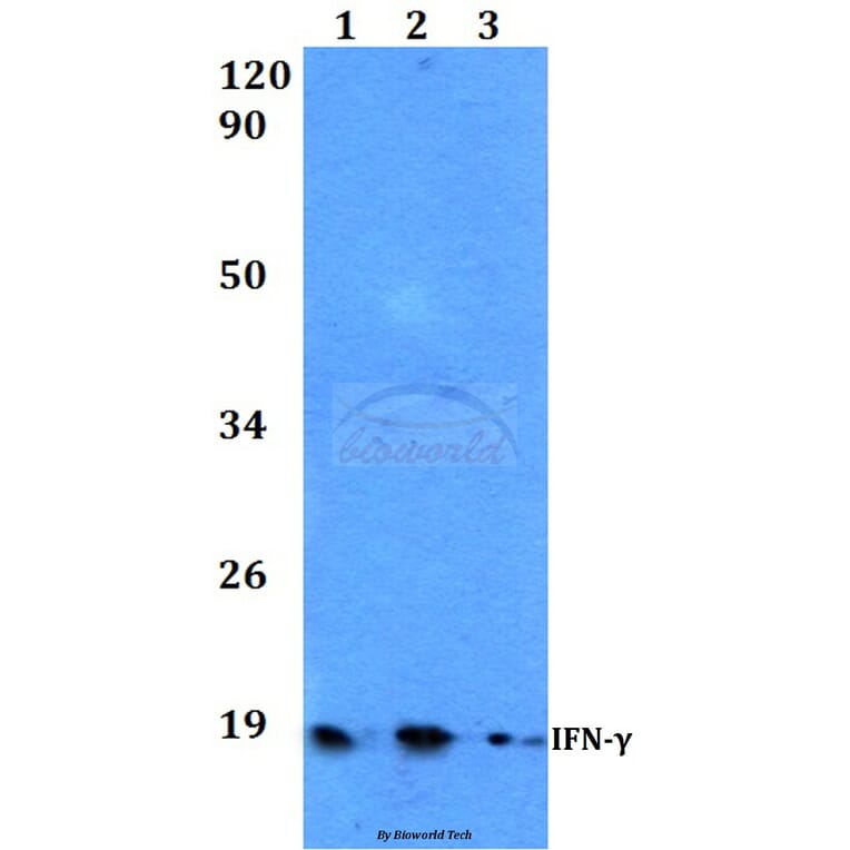 Anti-IFN-γ (Q69) Antibody from Bioworld Technology (BS3486) - Antibodies.com