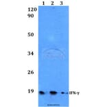 Anti-IFN-γ (Q69) Antibody from Bioworld Technology (BS3486) - Antibodies.com