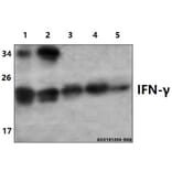 Anti-IFN-γ (Q69) Antibody from Bioworld Technology (BS3486) - Antibodies.com