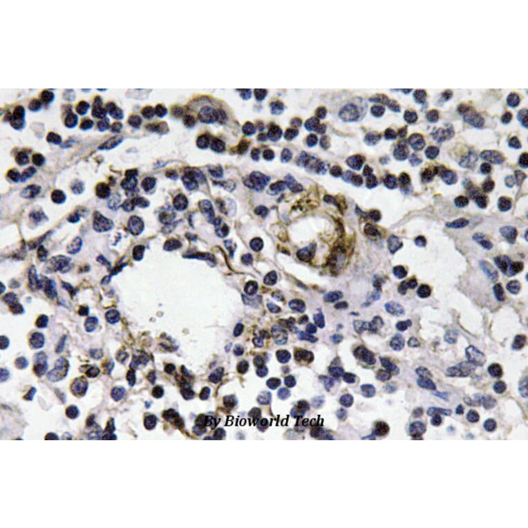 Anti-IFN-γ (Q69) Antibody from Bioworld Technology (BS3486) - Antibodies.com