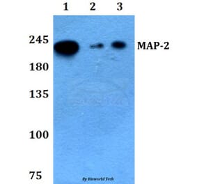 Anti-MAP-2 (W14) Antibody from Bioworld Technology (BS3487) - Antibodies.com