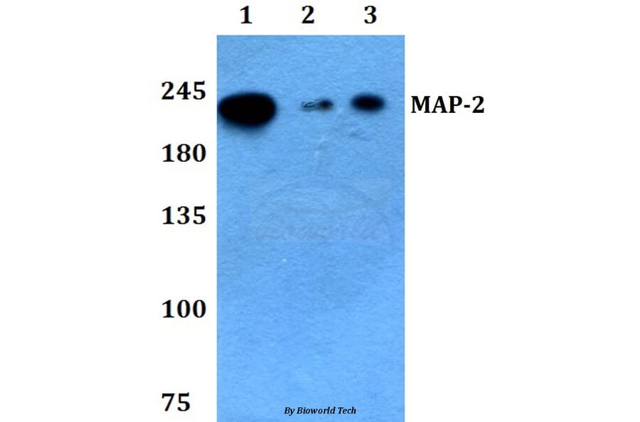 Anti-MAP-2 (W14) Antibody from Bioworld Technology (BS3487) - Antibodies.com