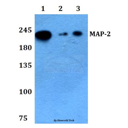 Anti-MAP-2 (W14) Antibody from Bioworld Technology (BS3487) - Antibodies.com