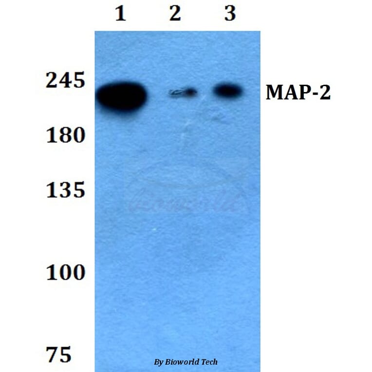 Anti-MAP-2 (W14) Antibody from Bioworld Technology (BS3487) - Antibodies.com