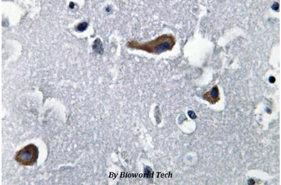 Anti-MAP-2 (W14) Antibody from Bioworld Technology (BS3487) - Antibodies.com