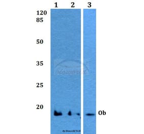 Anti-Ob (K36) Antibody from Bioworld Technology (BS3494) - Antibodies.com