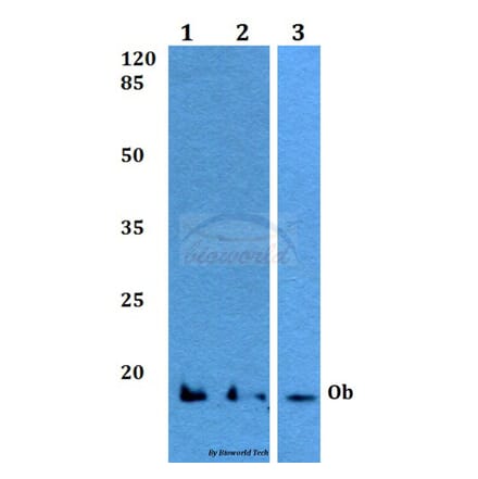 Anti-Ob (K36) Antibody from Bioworld Technology (BS3494) - Antibodies.com