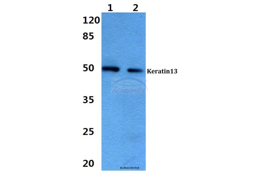 Anti-Cytokeratin 13 (E282) Antibody from Bioworld Technology (BS3504) - Antibodies.com