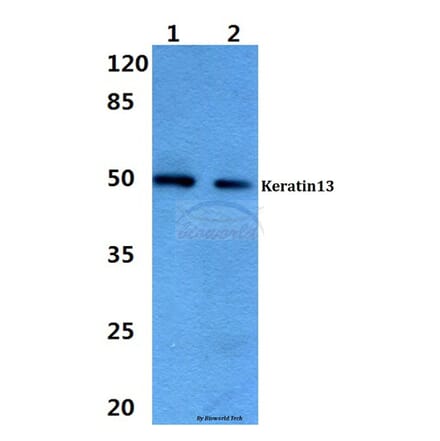 Anti-Cytokeratin 13 (E282) Antibody from Bioworld Technology (BS3504) - Antibodies.com