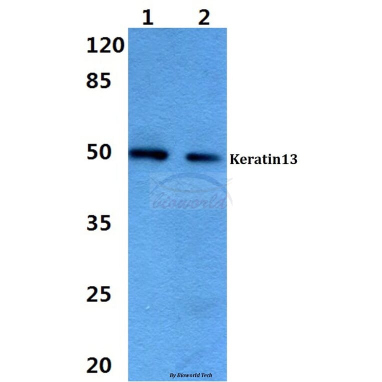 Anti-Cytokeratin 13 (E282) Antibody from Bioworld Technology (BS3504) - Antibodies.com