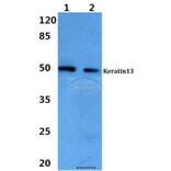 Anti-Cytokeratin 13 (E282) Antibody from Bioworld Technology (BS3504) - Antibodies.com