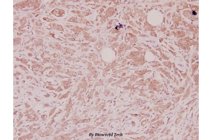 Anti-Defensin α1 (S52) Antibody from Bioworld Technology (BS3505) - Antibodies.com