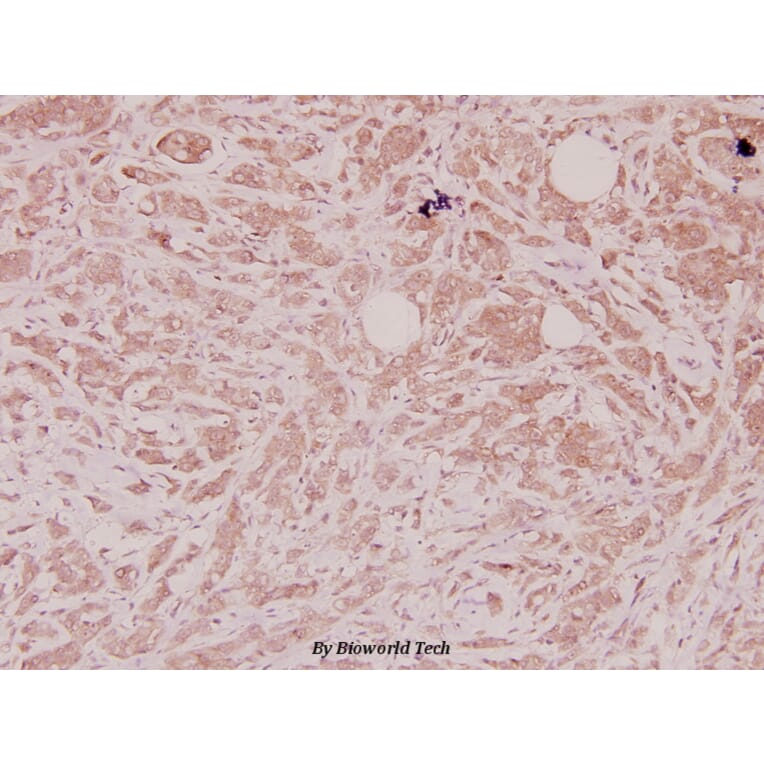 Anti-Defensin α1 (S52) Antibody from Bioworld Technology (BS3505) - Antibodies.com