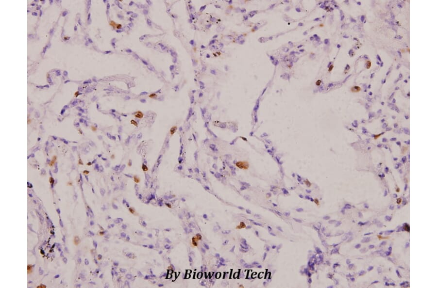 Anti-IL-1β (F162) Antibody from Bioworld Technology (BS3506) - Antibodies.com
