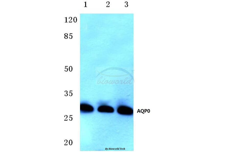 Anti-AQP0 (C144) Antibody from Bioworld Technology (BS3508) - Antibodies.com