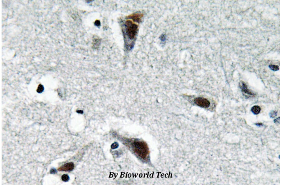 Anti-RFC3 (L227) Antibody from Bioworld Technology (BS3511) - Antibodies.com