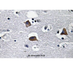 Anti-SDF-1 (M93) Antibody from Bioworld Technology (BS3512) - Antibodies.com